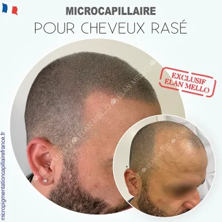 EFFET CHEVEUX RASÉ