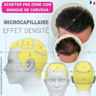 MICROCAPILLAIRE EFFET DENSITÉ PAR ZONE COM MANQUE DE CHEVEUX