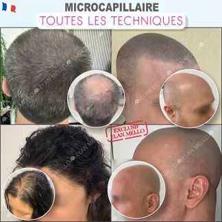 TOUTES LES TECHNIQUES